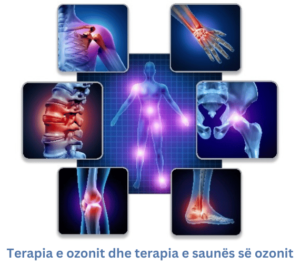 Terapia e ozonit dhe terapia e saunës së ozonit