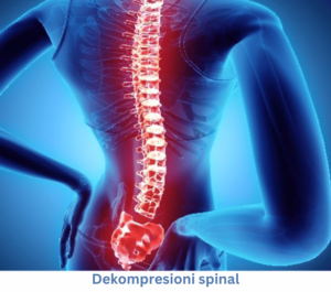 Dekompresioni spinal