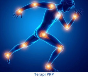 Terapi PRP